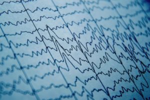 Human brain waves
